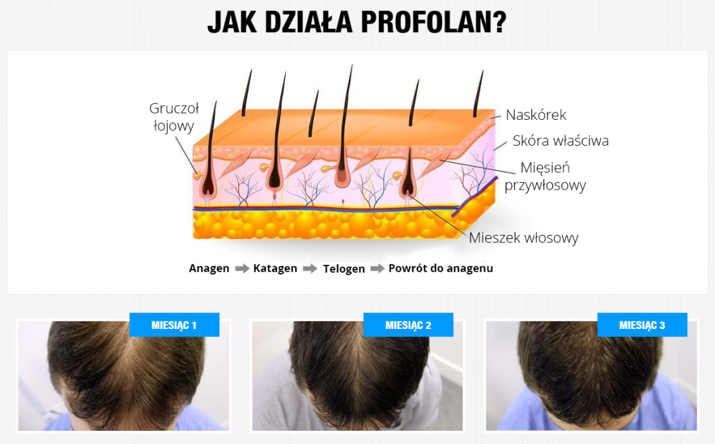 Profolan - na łysienie, wypadanie włosów, wzmocnienie włosów, stymulacja wzrostu nowych włosów, redukcja łysienia androgenowego, formuła Grow3, biotyna, miedź, witamina E, tauryna