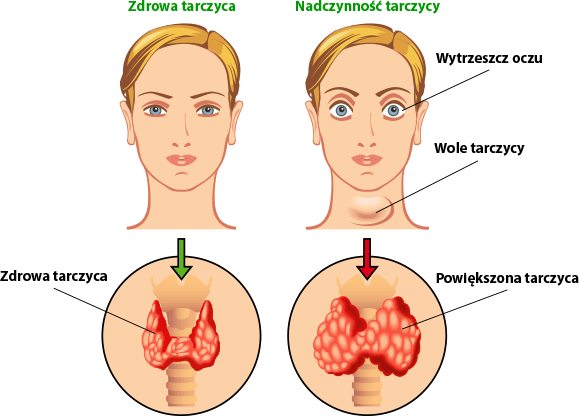 Thyrolin - tarczyca, wsparcie tarczycy, regulacja metabolizmu, wsparcie układu nerwowego, poprawa odporności, redukcja zmęczenia, ashwaganda, korzeń maca, selen, cynk, biotyna, BioPerina, pieprz czarny, witamina b12